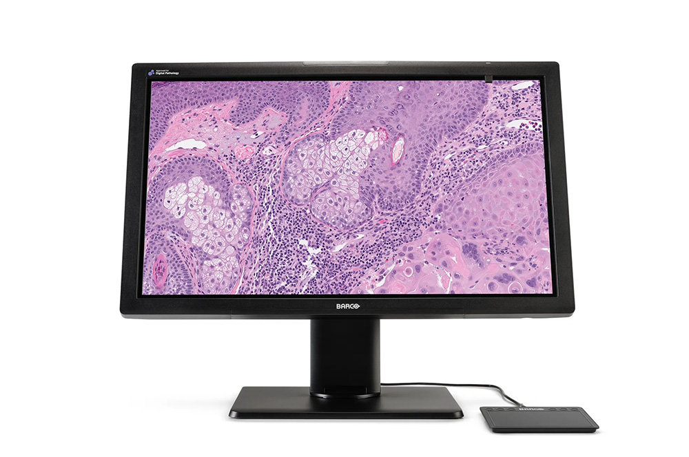 Barco 8MP 27" Color Digital Pathology Display (MDPC-8127)