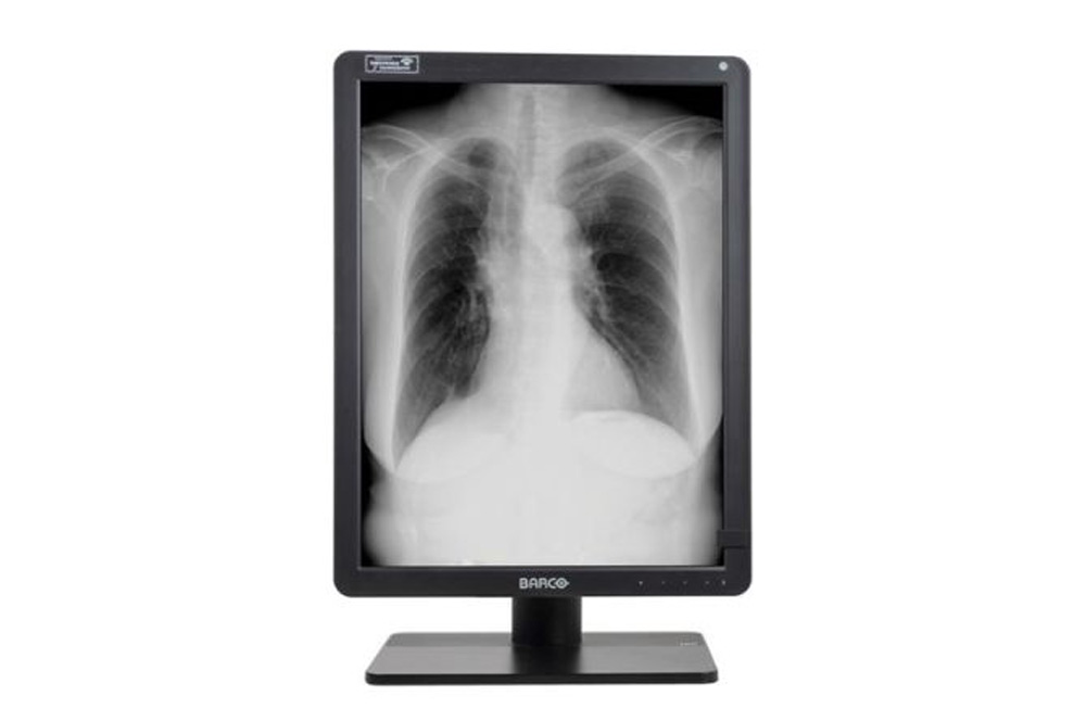 Barco Nio Gray 5.8MP 21" 1H1F (MDNG‑6221)