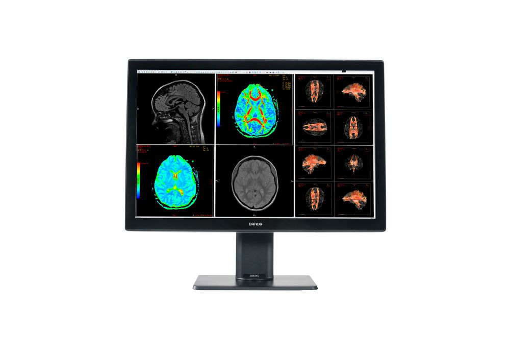 Barco Coronis Fusion 4MP 30" 1H1F (MDCC-4430)