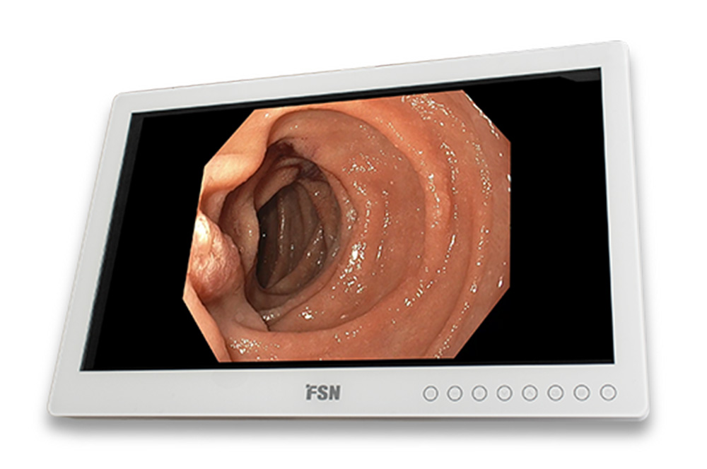 FSN FS-E2102D 21,5″ FHD-Medizin-Monitor