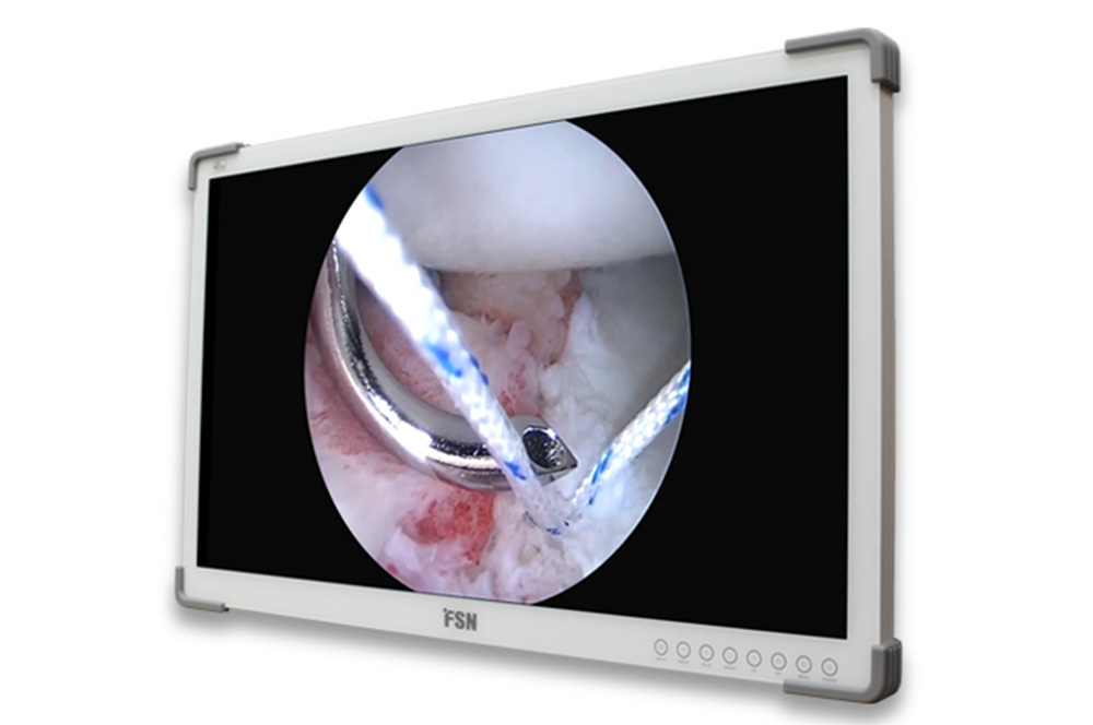 FSN FS-A3202DS 32″ FHD-Medizin-Monitor