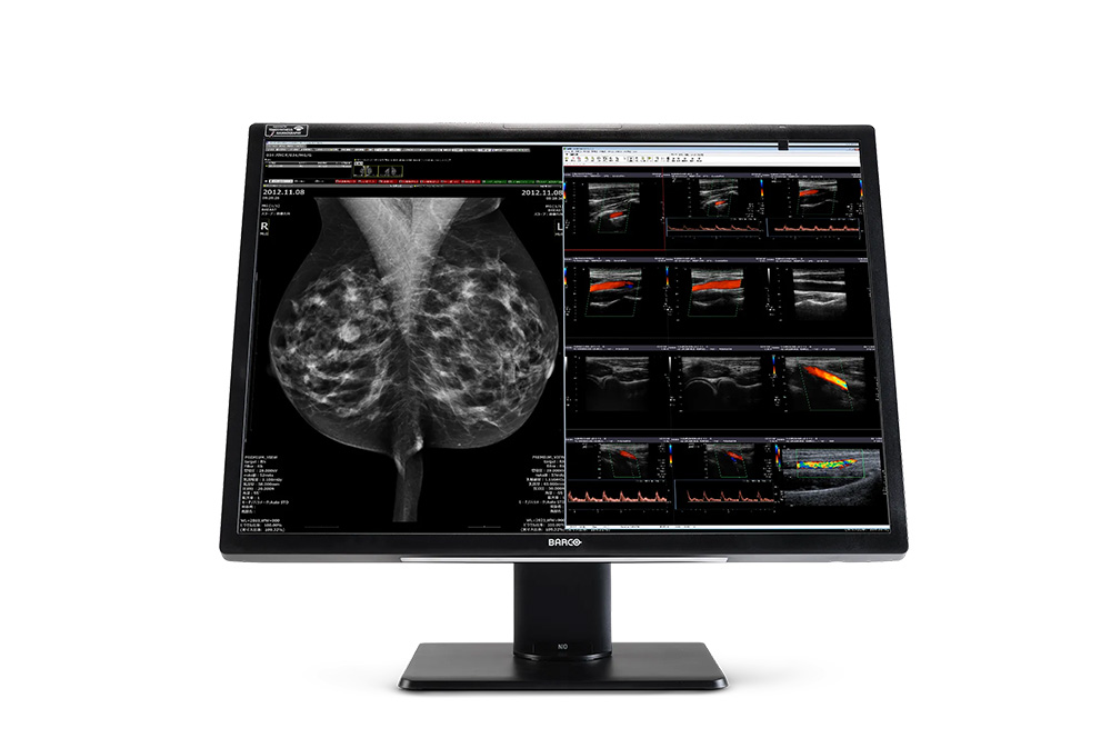 Barco Nio Fusion 12MP 30" 1H1F (MDNC-12130)