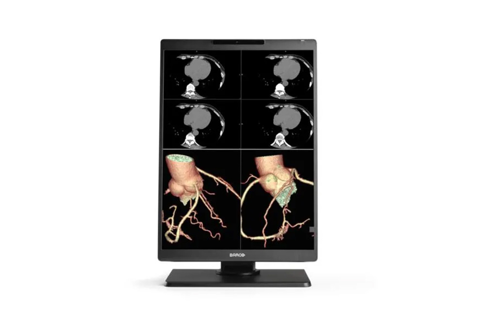 Barco Nio Color 2MP 21" 1H1F (MDNC‑2521)