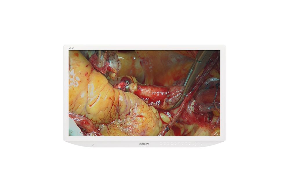 Medizinischer 32“ 4K-/2D-/LCD-Monitor Sony LMD-X3200MD 