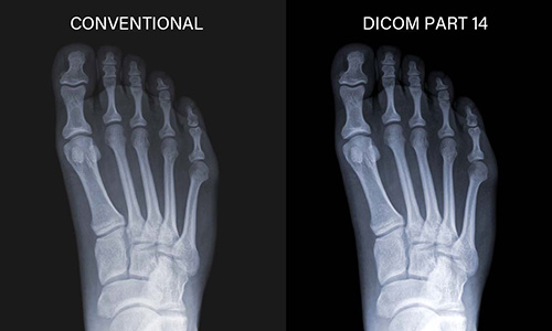 DICOM-14