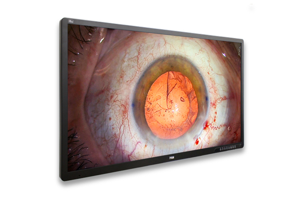 FSN FM-A5505DGC 55" Medizin 4K 3D-Monitor