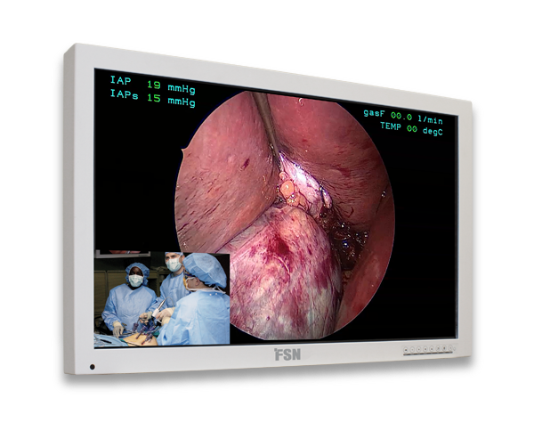 FSN FS-L3202D 32″ HD-Medizin-Monitor