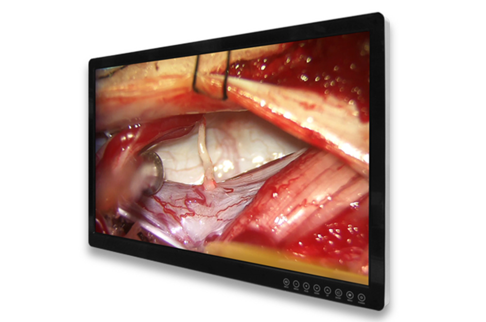 FSN FM-E3204DGC 32" Medizin 4K 3D-Monitor