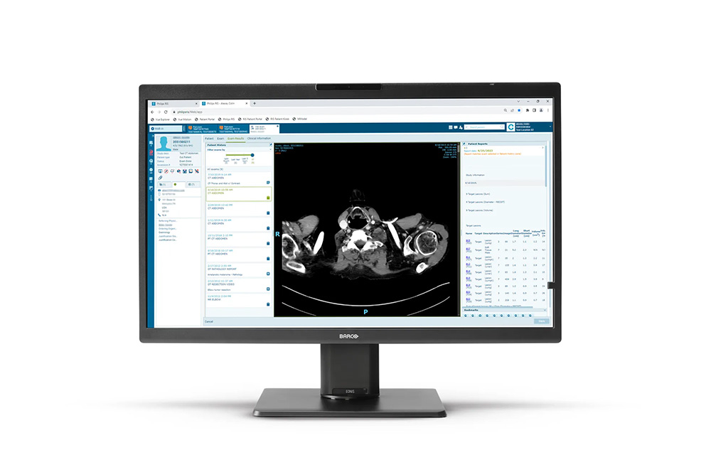 Barco Eonis Color 8MP Monitor (MDRC‑8132)