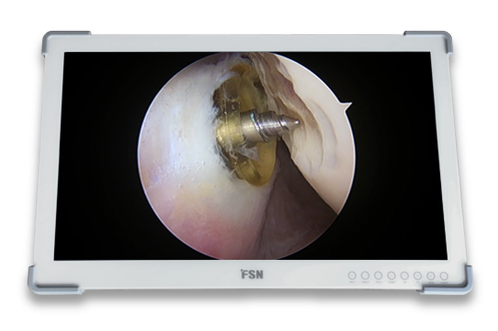 FSN FSN FS-A2702DS 27″ FHD-Medizin-Monitor 